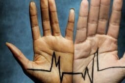 Two hands with an EKG diagram across them