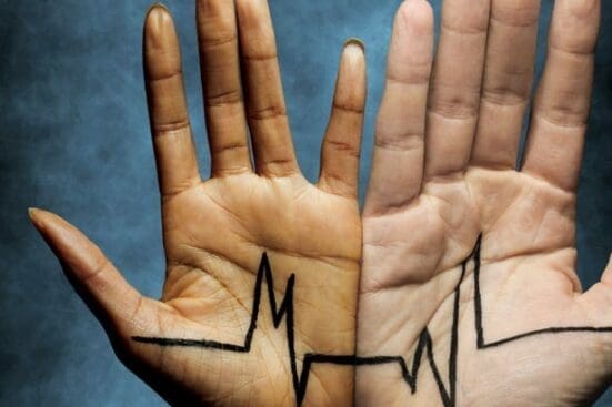 Two hands with an EKG diagram across them