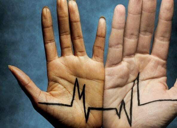 Two hands with an EKG diagram across them